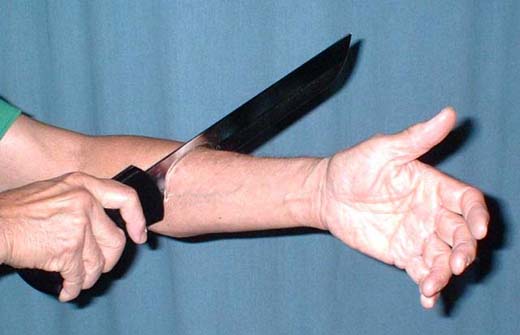 knife thru arm